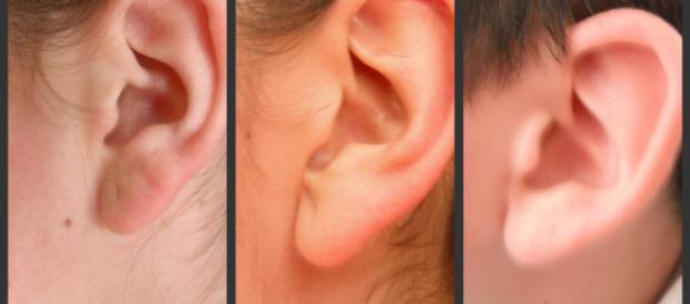La herencia de las generaciones: LÓBULO DE LA OREJA - blogspot.com La herencia de las generaciones: LÓBULO DE LA OREJA - blogspot.com