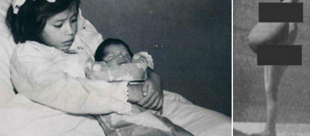 O curioso caso de Lina Medina. O curioso caso de Lina Medina.