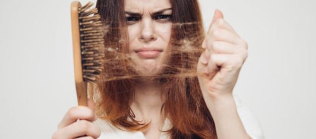 Alopecia en mujeres: Pérdida de cabello | Clínica Internacional - com.pe Alopecia en mujeres: Pérdida de cabello | Clínica Internacional - com.pe
