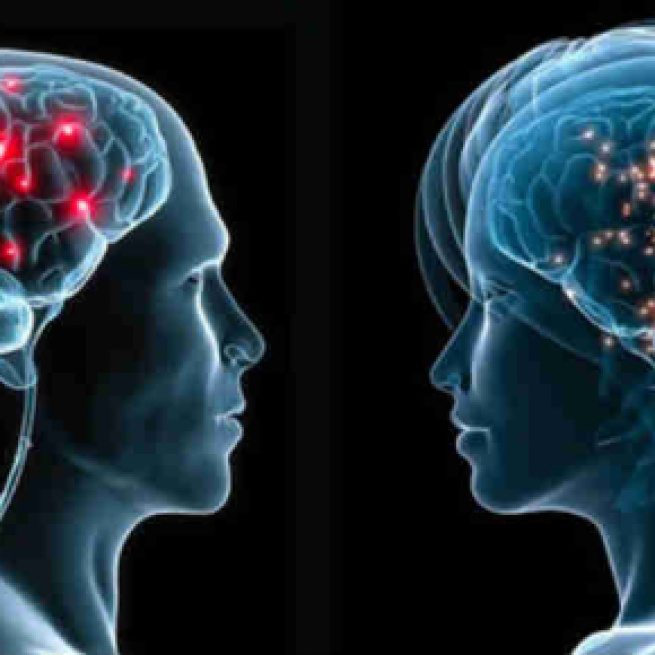 In alto, un cervello umano e i suoi neuroni