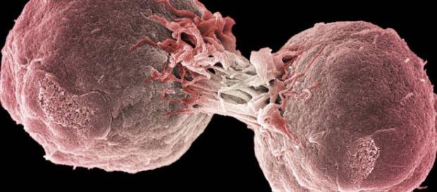 Inmunoterapia: El tratamiento contra el cáncer que sustituirá a la elpais.com Inmunoterapia: El tratamiento contra el cáncer que sustituirá a la elpais.com