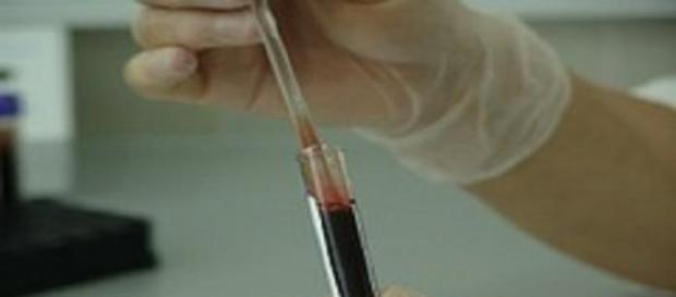 Virus Dengue, trasmissione con rapporto sessuale: come si manifesta, cosa sapere sull'argomento Virus Dengue, trasmissione con rapporto sessuale: come si manifesta, cosa sapere sull'argomento