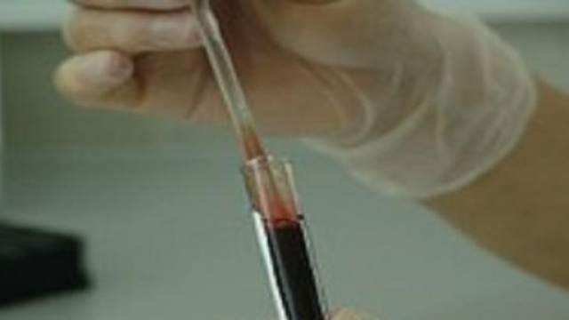 Virus Dengue, trasmissione con rapporto sessuale: come si manifesta, cosa sapere sull'argomento