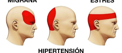 Descubre cuáles son los tipos de dolor de cabeza que existen, y cuáles son sus principales causas