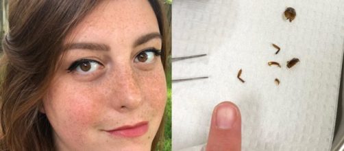 Scarafaggio nell'orecchio di Katie Holley: insetti attratti dal ... - zz7.it