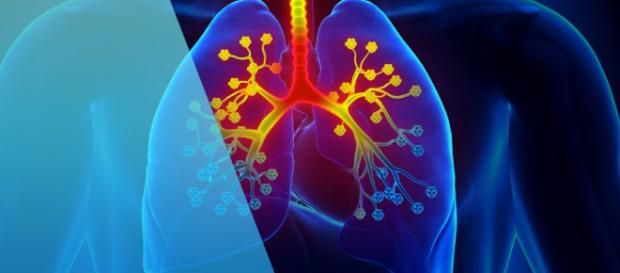 Fibrosis quística: tus propias mucosidades, el enemigo - acunsa.es Fibrosis quística: tus propias mucosidades, el enemigo - acunsa.es