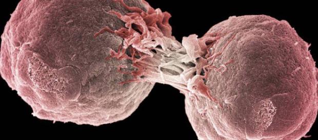 Inmunoterapia: El tratamiento contra el cáncer que sustituirá a la- elpais.com Inmunoterapia: El tratamiento contra el cáncer que sustituirá a la- elpais.com