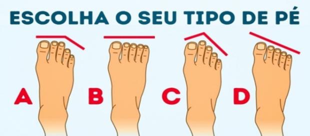 O formato dos dedos do pé pode dizer mais sobre sua personalidade O formato dos dedos do pé pode dizer mais sobre sua personalidade
