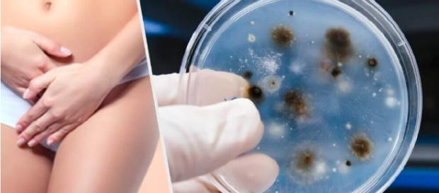 Tipos de infecções íntimas das mulheres Tipos de infecções íntimas das mulheres
