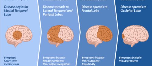 Alzheimer ed herpesvirus umano