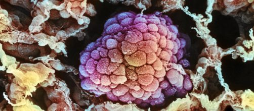 El Vall d'Hebrón halla un nuevo factor que 'adormece' las células tumorales