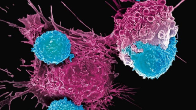 Si pu&ograve; istruire il sistema immunitario a combattere i tumori