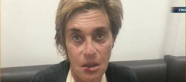Sálvame: Chelo García Cortés se parte el labio en una aparatosa caída Sálvame: Chelo García Cortés se parte el labio en una aparatosa caída