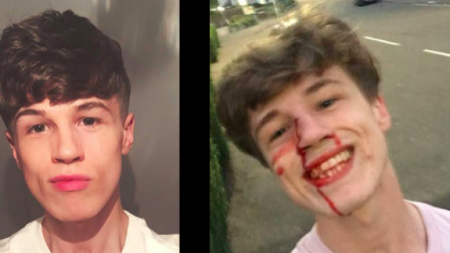 Blair Wilson combatte le violenze omofobe con un selfie