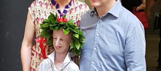 Sammy Basso, el chico progeria, se graduó en Ciencias Naturales Sammy Basso, el chico progeria, se graduó en Ciencias Naturales