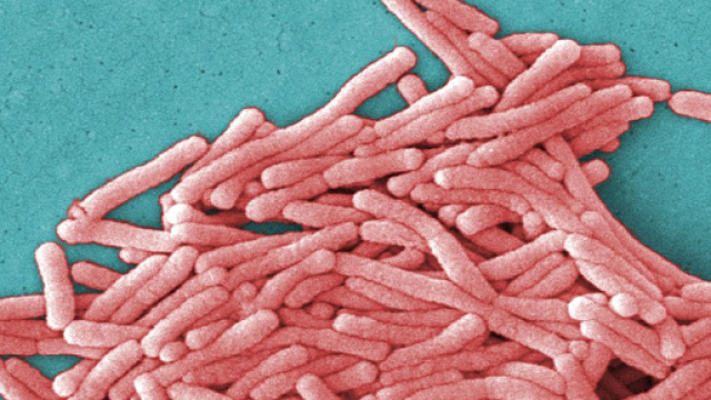 Lagionella al microscopio, allarme sanitario
