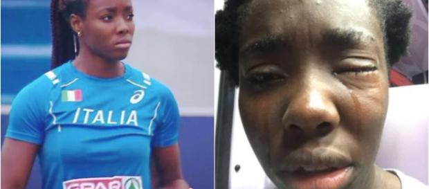 Moncalieri: Colpita da un uovo perché è di colore, in ospedale l'atleta azzurra Daisy Osakue Moncalieri: Colpita da un uovo perché è di colore, in ospedale l'atleta azzurra Daisy Osakue