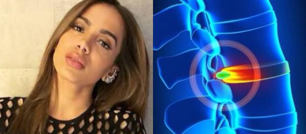 Cantora pop brasileita, Anitta Cantora pop brasileita, Anitta