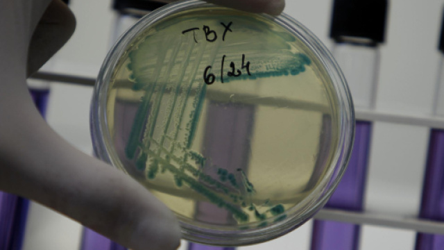 Universit&agrave; Federico II: nuovi antibiotici contro i batteri farmaco-resistenti