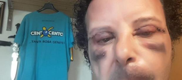 L'attore Alex Magni vittima di un'aggressione L'attore Alex Magni vittima di un'aggressione