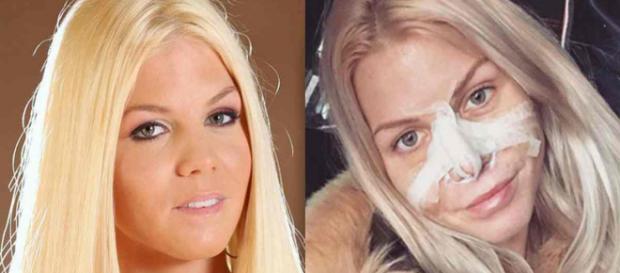 LMvsMonde3 : Jessica Thivenin va subir une nouvelle opération de chirurgie esthétique LMvsMonde3 : Jessica Thivenin va subir une nouvelle opération de chirurgie esthétique
