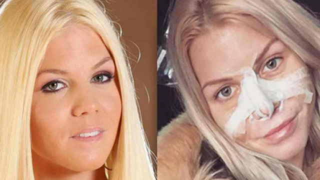 LMvsMonde3 : Jessica Thivenin va subir une nouvelle opération de chirurgie esthétique