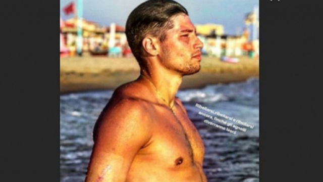 Nicolò Bettarini mostra i segni delle 11 coltellate.