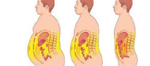 Il grasso corporeo in eccesso può aumentare il rischio di cancro del colon