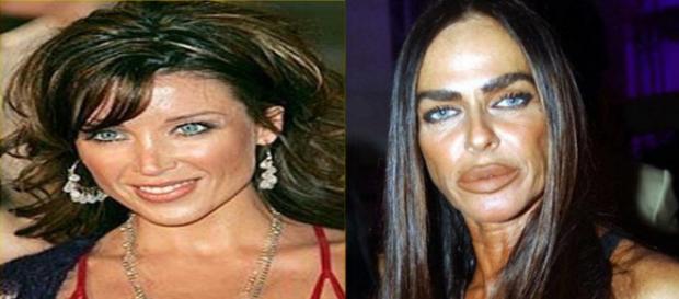 As celebridades que exageraram nas cirurgias plásticas. (Foto: Reprodução Internet). As celebridades que exageraram nas cirurgias plásticas. (Foto: Reprodução Internet).