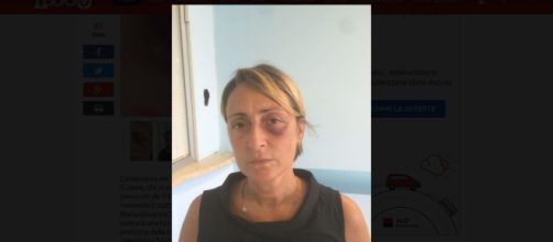 Lecce, infermiera 118 presa a calci e pugni: la donna mostra le foto dell'aggressione subita in ambulanza.
