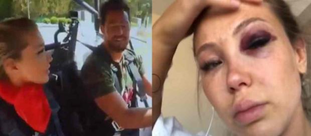 Les Vacances des Anges 3 : Andréane dévoile les images impressionnantes de son accident de buggy. Les Vacances des Anges 3 : Andréane dévoile les images impressionnantes de son accident de buggy.