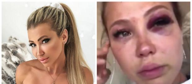 Les Vacances des Anges 3 : Andréane continue de balancer sur Rémi après leur accident Les Vacances des Anges 3 : Andréane continue de balancer sur Rémi après leur accident
