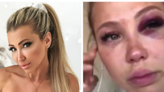 Les Vacances des Anges 3 : Andréane continue de balancer sur Rémi après leur accident