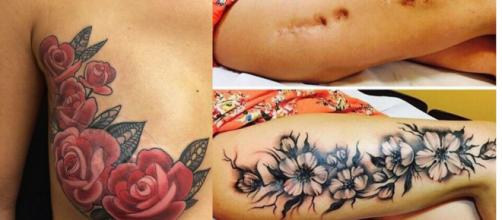 Cicatrizes que ganharam vida nova com tatuagem. (Foto/Reprodução via Virgula.com)