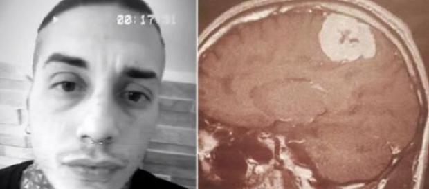 Francesco Chiofalo, parla la madre: 'Non si sa se il tumore è benigno o no'. Francesco Chiofalo, parla la madre: 'Non si sa se il tumore è benigno o no'.