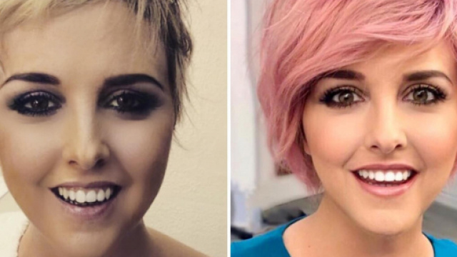 Nadia Toffa torna a Le Iene con i suoi capelli