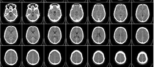 grandi polemiche sulla vicenda di Lenticchio