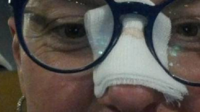 Colpita da una pallonata di Ronaldo, posta il selfie su fb ... - ilgiornale.it