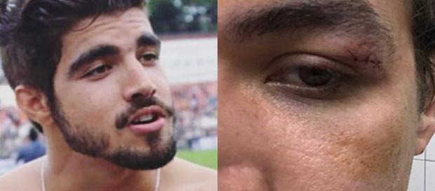 Caio Castro e o rapaz agredido (Foto - Reprodução) Caio Castro e o rapaz agredido (Foto - Reprodução)