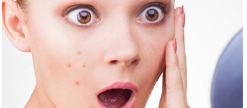 I retinoidi topici sono tutti efficienti e ben tollerati contro l’acne vulgaris.