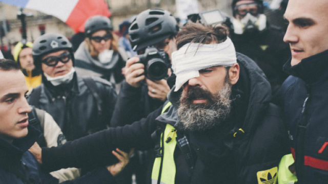 Acte 11 : le Gilet jaune Jérôme Rodrigues gravement blessé à l'oeil - lejdd.fr