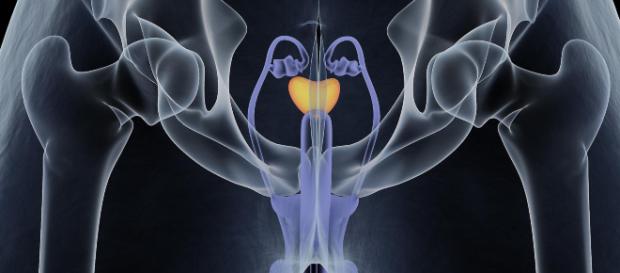 Cancro ai testicoli: alcuni campanelli d'allarme Cancro ai testicoli: alcuni campanelli d'allarme