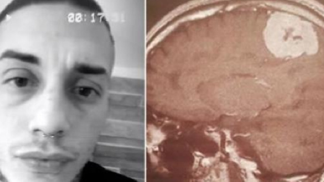 Francesco Chiofalo, intervento riuscito: il ragazzo &egrave; in terapia intensiva, ma cosciente.