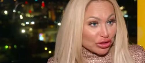 "90 Day Fiance" fans fear Darcey was wasted and had way too much botox during an interview with ET - Image credit - ET / YouTube