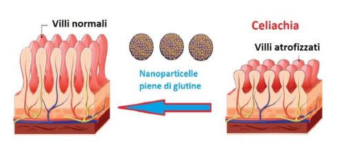 Una nuova tecnologia basata sull’uso di nanoparticelle potrebbe bloccare la reazione al glutine nei celiaci.