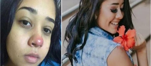 Jovem de 21 anos fica paraplégica após colocar piercing no nariz (Foto: Instagram)