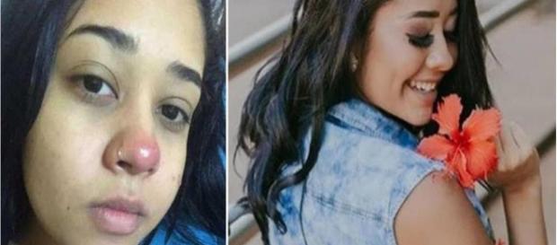 Jovem de 21 anos fica paraplégica após colocar piercing no nariz (Foto: Instagram) Jovem de 21 anos fica paraplégica após colocar piercing no nariz (Foto: Instagram)