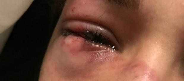 Bolzano, ragazza di 15 anni aggredita da compagne di classe Bolzano, ragazza di 15 anni aggredita da compagne di classe
