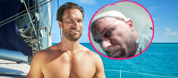 Bei SAT1 in "Endlich Feierabend!" zeigt Bastian Yotta seine Haartransplantation. Bei SAT1 in "Endlich Feierabend!" zeigt Bastian Yotta seine Haartransplantation.