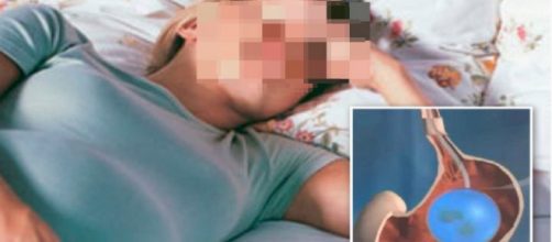 Sicilia, 40enne ingerisce palloncino gastrico per dimagrire. Muore tra dolori atroci - Teleclubitalia